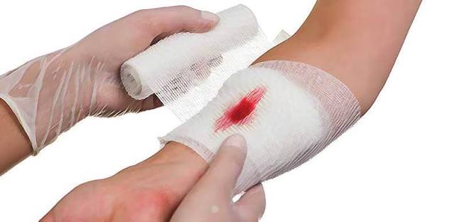 خونریزی وریدی