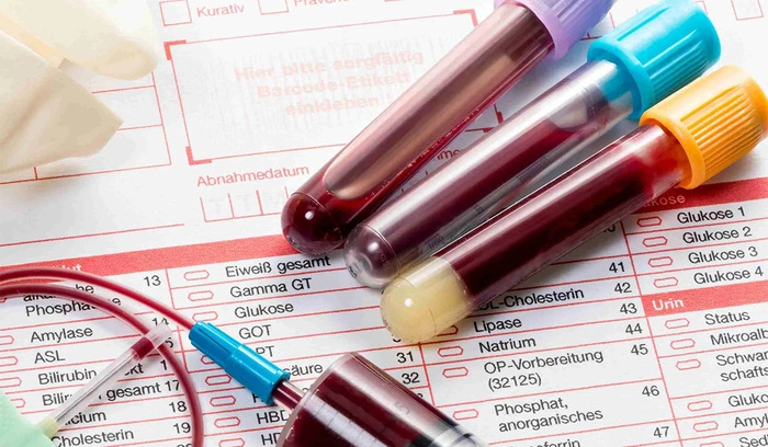 لوله‌های آزمایش خون