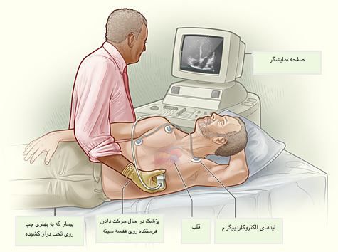 اینفوگرافی مراحل انجام اکو قلب در منزل