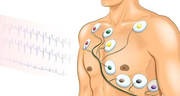 اینفوگرافی مراحل گرفتن نوار قلب در منزل
