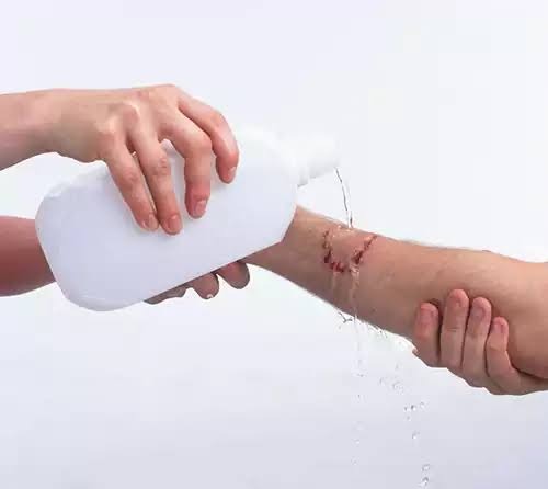 شست‌وشوی اولیه زخم ناشی از ترکش ریز با آب تمیز