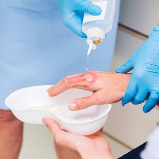 مراحل تمیز کردن زخم